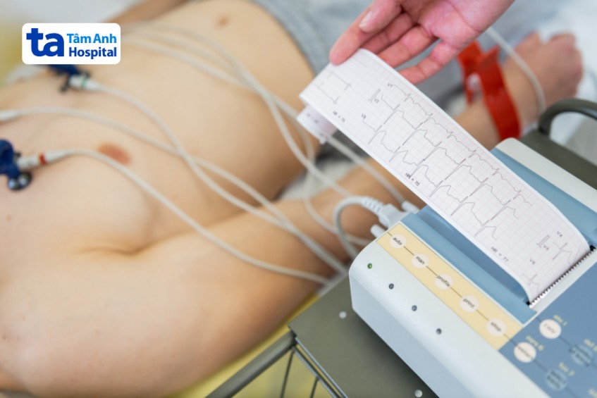 máy đo điện tâm đồ