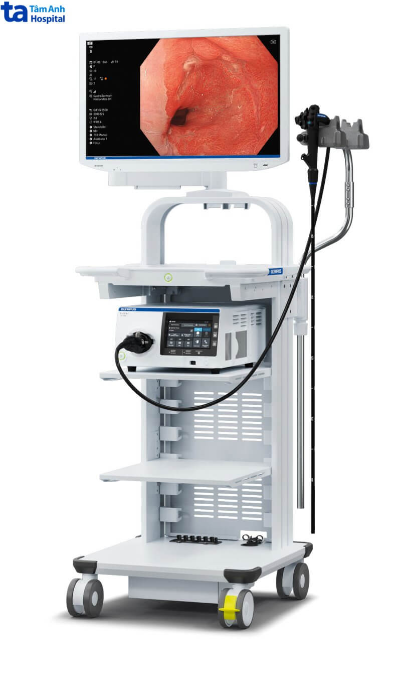 máy nội soi dạ dày