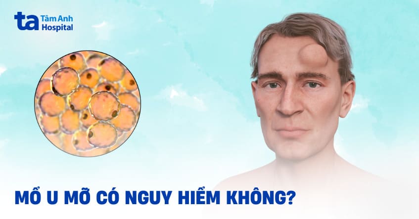 Mổ u mỡ có nguy hiểm không? Quy trình phẫu thuật như thế nào?