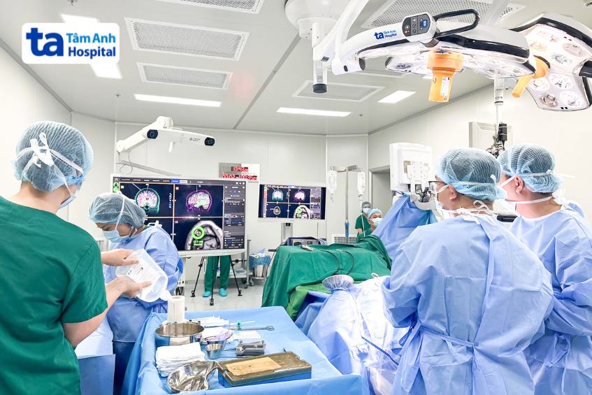 neuro navigation hỗ trợ phẫu thuật mở hộp sọ tại tâm anh