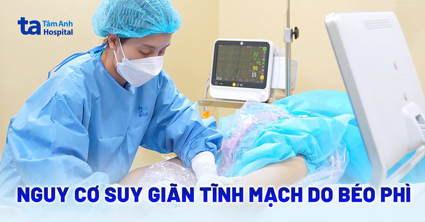 Nguy cơ suy giãn tĩnh mạch, loét chân do béo phì