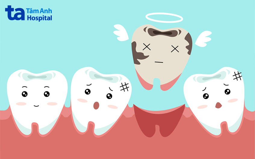 Ảnh hưởng của răng bị mọc lệch