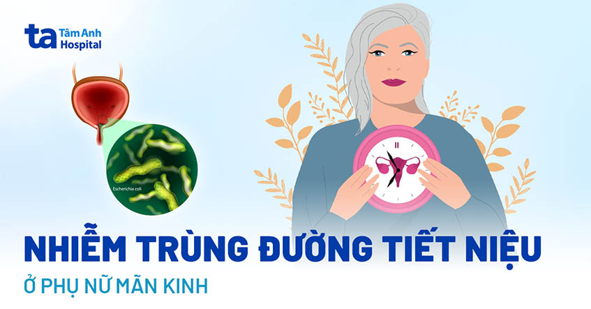 Nhiễm trùng đường tiết niệu ở phụ nữ mãn kinh: Nguyên nhân, dấu hiệu