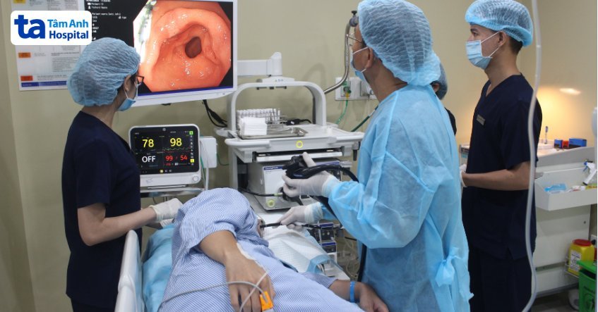 nội soi tiêu hóa không gây đau