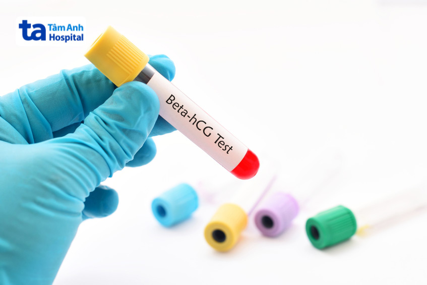 Nồng độ beta hCG dưới 5 mIU/ml đồng nghĩa chuyển phôi thất bại