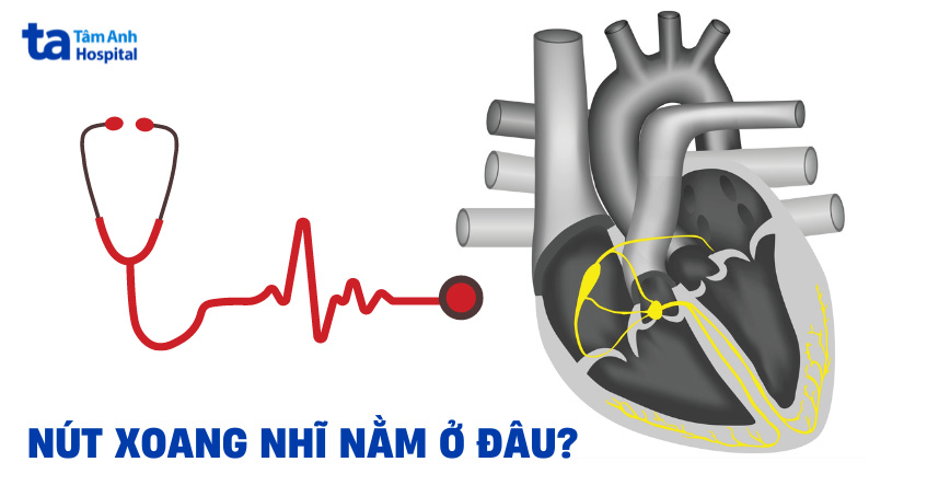 Nút xoang nhĩ nằm ở đâu?