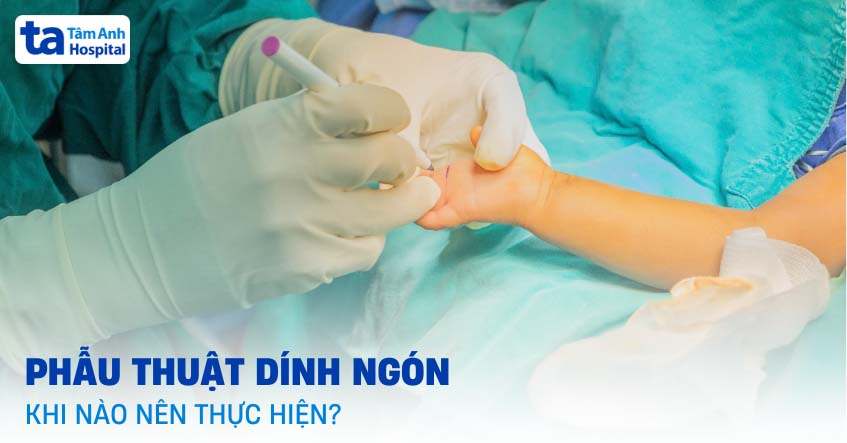Phẫu thuật tách dính ngón là gì? Khi nào nên thực hiện? Rủi ro gì?