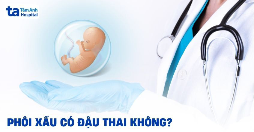 Phôi xấu có đậu thai không? Nên chuyển hay chờ nuôi phôi tốt?
