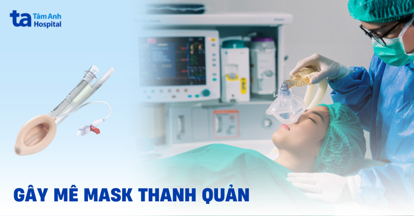 Phương pháp gây mê mask thanh quản: Ưu điểm, chỉ định và quy trình