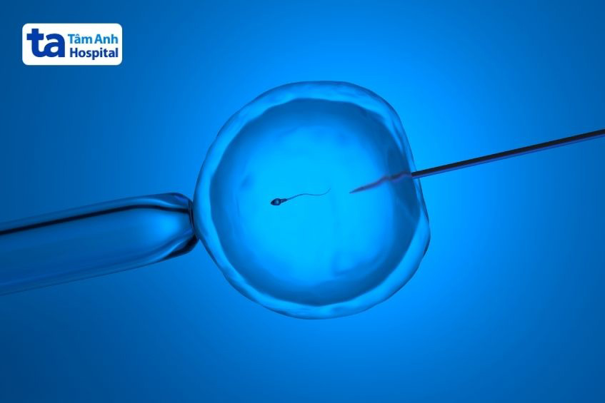 Phương pháp thụ tinh trong ống nghiệm (IVF)