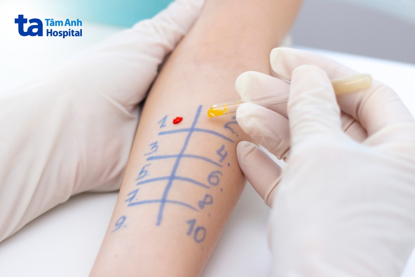 quy trình xét nghiệm 36 dị nguyên bao nhiêu tiền