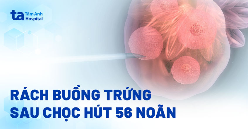 rách buồng trứng sau chọc hút noãn
