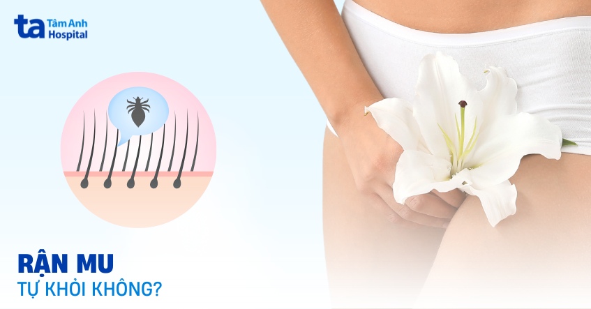 rận mu có tự hết không