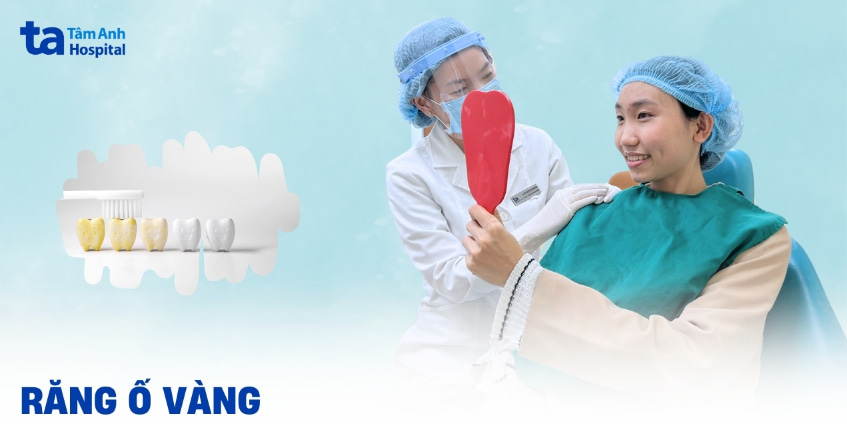 Răng ố vàng: Nguyên nhân, cách khắc phục và hạn chế ngả vàng