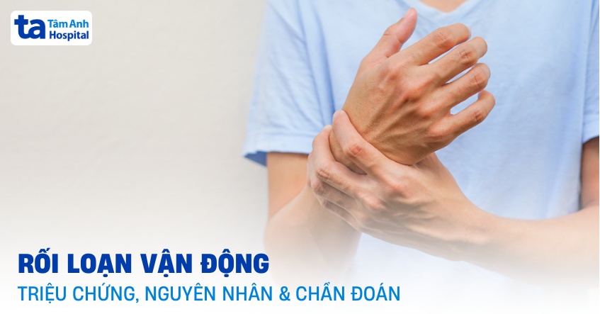 rối loạn vận động