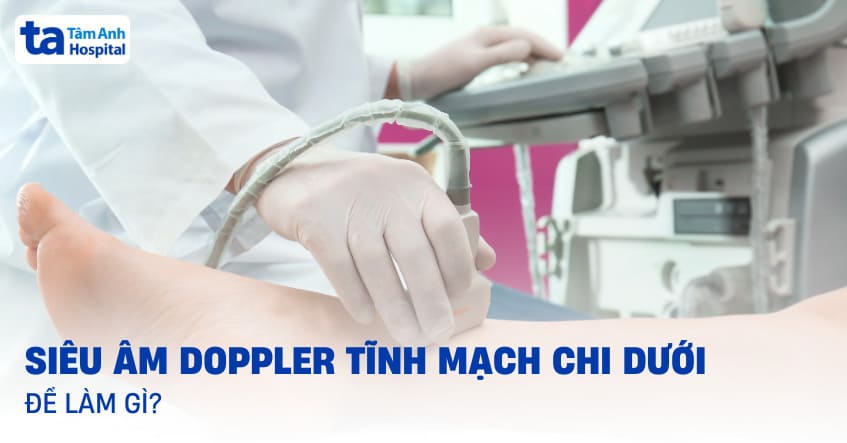 Siêu âm Doppler tĩnh mạch chi dưới để làm gì? Chỉ định và quy trình