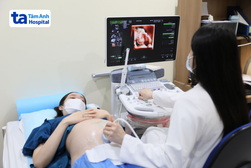 siêu âm thai