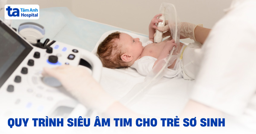 Siêu âm tim cho trẻ sơ sinh: Ý nghĩa, chỉ định và quy trình [A-Z]