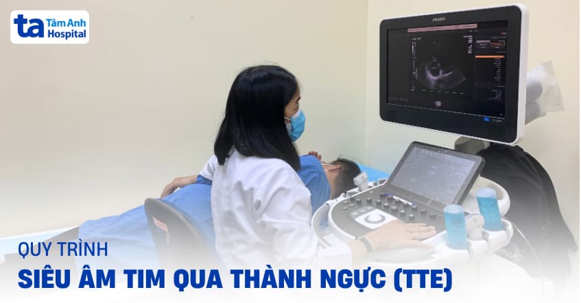Siêu âm tim qua thành ngực (TTE): Vai trò, chỉ định và quy trình