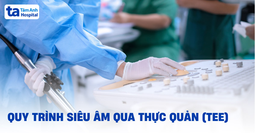 Siêu âm tim qua thực quản (TEE): Vai trò, chỉ định và quy trình