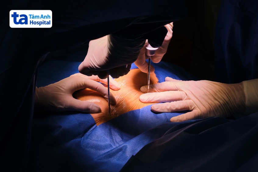 giải pháp sinh thiết tủy xương chẩn đoán suy tủy để biết bị suy tủy có nguy hiểm không