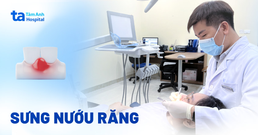 sưng nướu răng