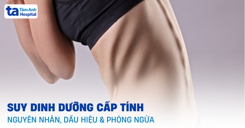 Suy dinh dưỡng cấp tính: Nguyên nhân, dấu hiệu và phòng ngừa