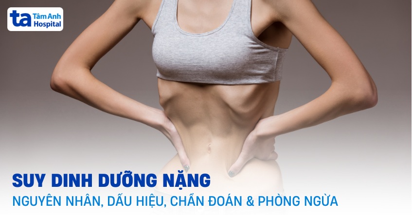 Suy dinh dưỡng nặng: Nguyên nhân, dấu hiệu, chẩn đoán và phòng ngừa