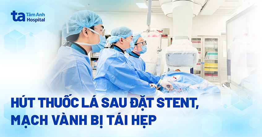 Tái hẹp mạch máu tim vì không tuân thủ điều trị