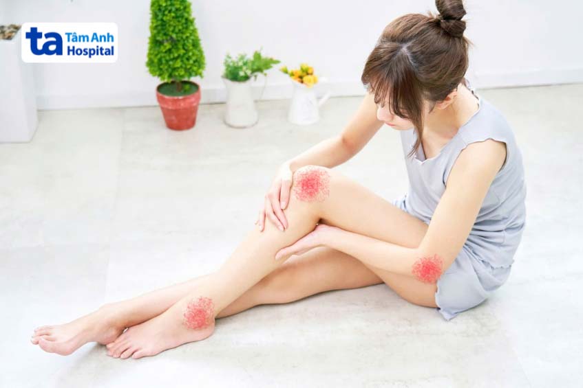 Tại sao khớp lại kiêu lụp cụp