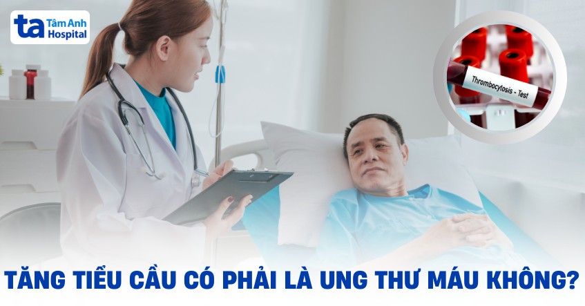 Bệnh tăng tiểu cầu có phải là ung thư máu không? Một số lưu ý