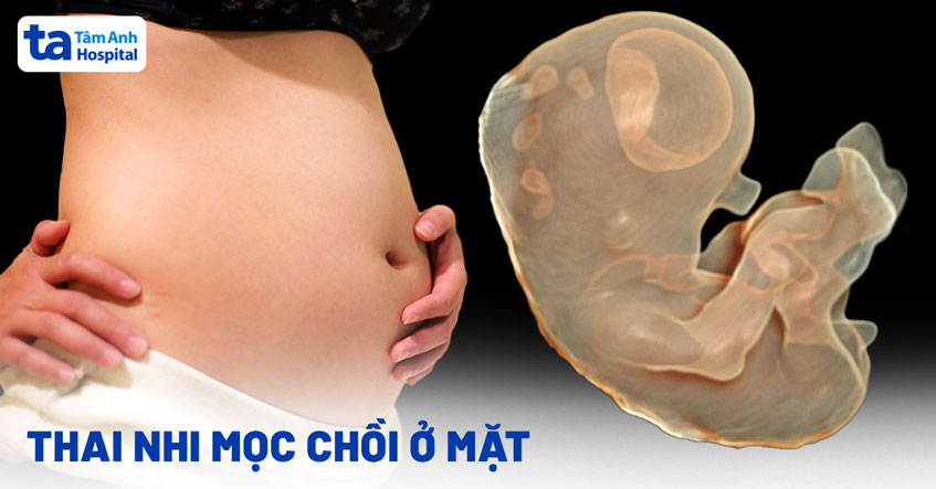 thai nhi mọc chồi ở mắt