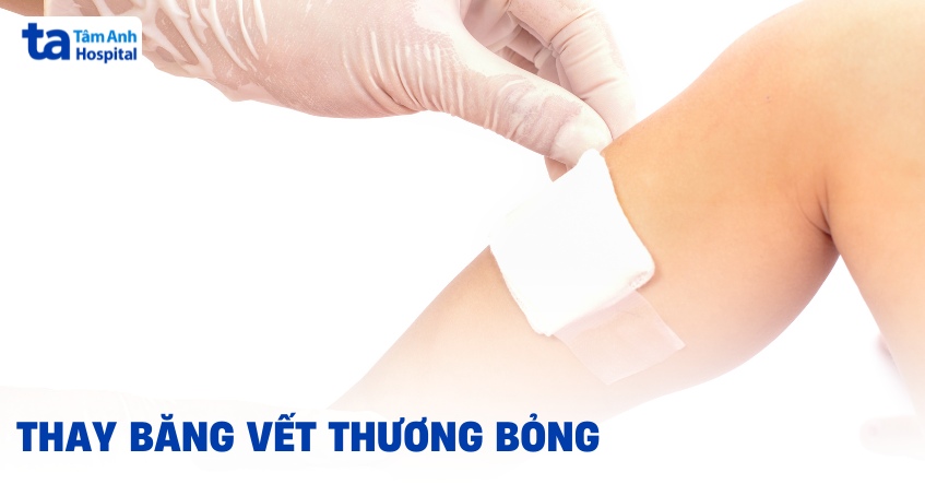 6 bước thay băng vết thương bỏng đúng chuẩn và những điều lưu ý