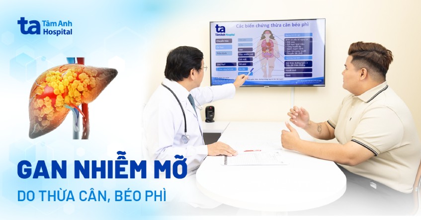 Thừa cân, béo phì: “đường tắt” đến gan nhiễm mỡ