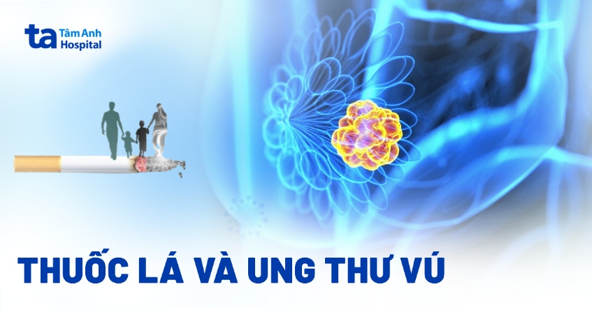 Thuốc lá và ung thư vú: Thống kê, mối liên hệ và yếu tố nguy cơ