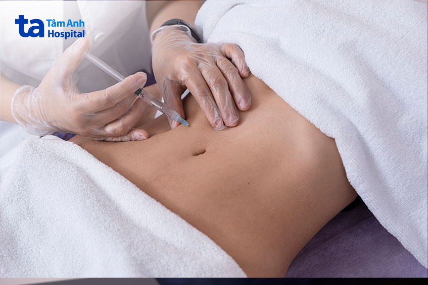 tiêm thuốc vào vùng bụng