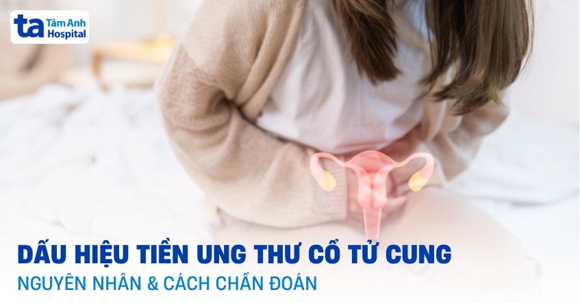 Tiền ung thư cổ tử cung: Dấu hiệu, nguyên nhân và chẩn đoán