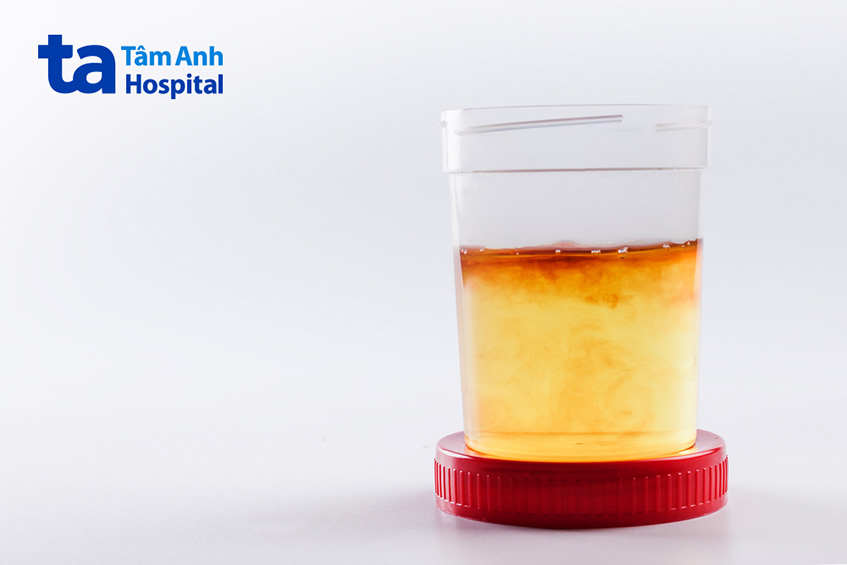 Dấu hiệu nhiễm trùng đường tiết niệu ở phụ nữ mãn kinh