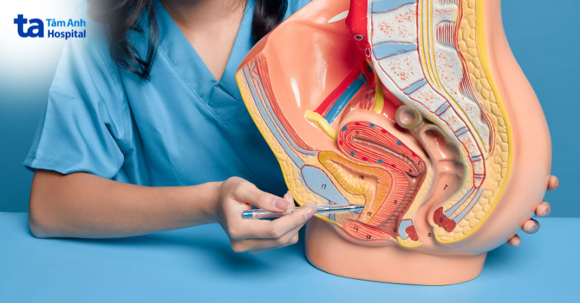 tình trạng sa ở bàng quang