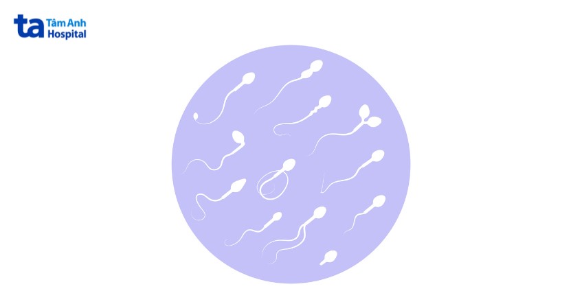 Tinh trùng bị dị dạng có chữa được không?