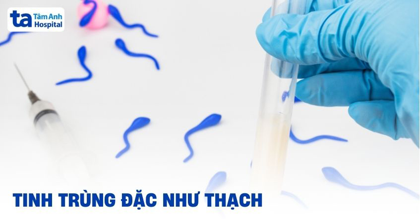 Tinh trùng đặc như thạch có sao không? Nguyên nhân do đâu?
