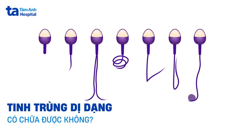 Tinh trùng dị dạng có chữa được không