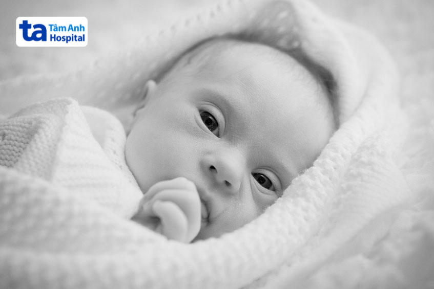 trẻ bị mắc bệnh down