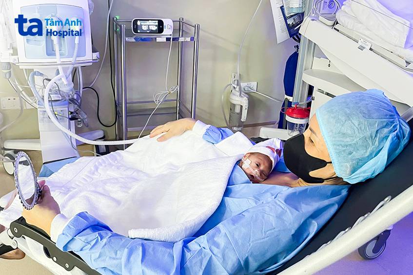 Trẻ sinh non được da kề da trong phòng NICU