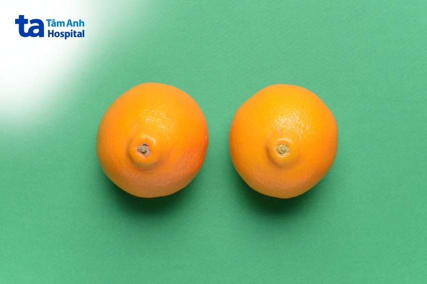 triệu chứng ung thư vú Luminal B