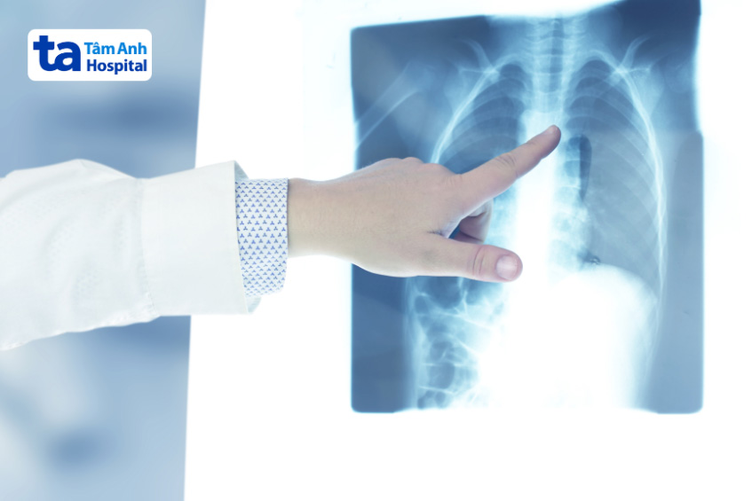 Trung thất là khoang nằm trong lồng ngực, ở giữa hai phổi