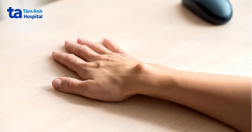 U mỡ có thể xuất hiện tại nhiều vị trí