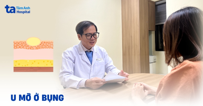 U mỡ ở bụng có nguy hiểm không? Dấu hiệu, nguyên nhân, điều trị