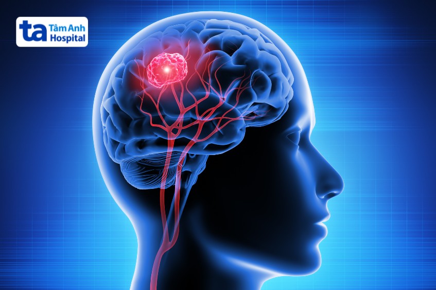 u não có thể chỉ định phẫu thuật mở hộp sọ