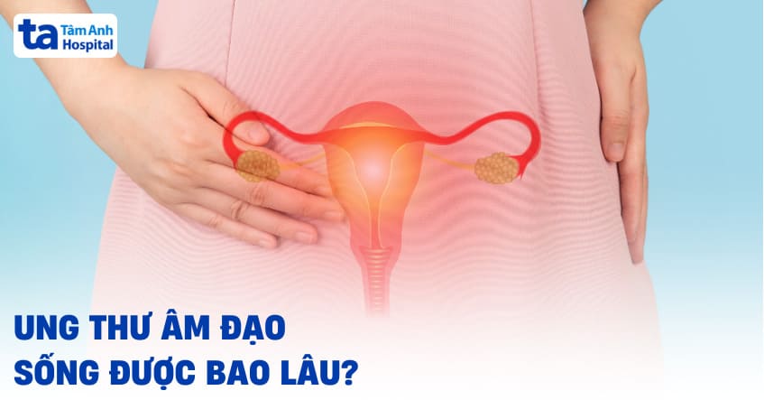 Ung thư âm đạo sống được bao lâu?
